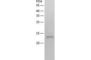 Western Blotting (WB) image for WAP Four-Disulfide Core Domain 2 (WFDC2) (AA 31-124) protein (His tag) (ABIN7282981) (WFDC2 Protein (AA 31-124) (His tag))