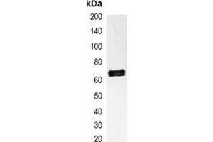 Immunoprecipitation of NF-kappaB p65 from 0. (NF-kB p65 antibody)