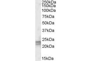 EB08871 (0. (ARL4D antibody  (Internal Region))