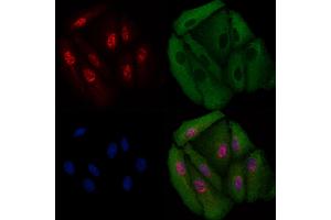 ABIN6258847 and ABIN6275709 staining  cells by IF/ICC.