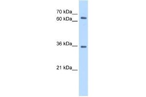WB Suggested Anti-PPP2R3B Antibody Titration:  0.