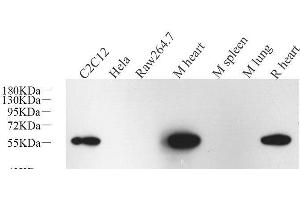 Western Blot analysis of various samples using Desmin Monoclonal Antibody at dilution of 1:1000. (Desmin antibody)
