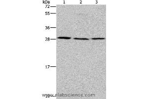 Western blot analysis of Human fetal liver tissue, 293T and 231 cell, using TP53INP1 Polyclonal Antibody at dilution of 1:200