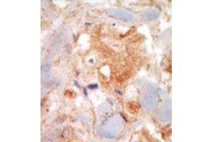 Image no. 2 for anti-Mast/stem Cell Growth Factor Receptor (KIT) (N-Term) antibody (ABIN359890) (KIT antibody  (N-Term))