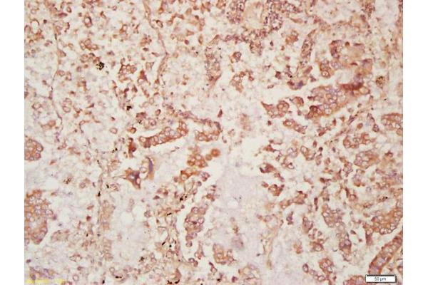 DISP2 antibody  (AA 1101-1200)