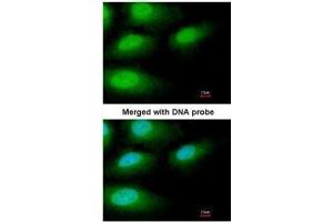 ICC/IF Image Immunofluorescence analysis of paraformaldehyde-fixed HeLa, using IRAK3, antibody at 1:200 dilution. (IRAK3 antibody)