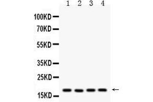 Western blot analysis of Cyclophilin A using anti- Cyclophilin A antibody . (PPIA antibody  (AA 116-165))