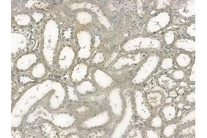 ABIN6255311 and ABIN6267132 at 1/100 staining human normal kidney tissue by IHC-P. (KSR1 antibody  (pSer392))