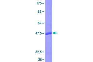 Image no. 1 for Interleukin 17F (IL17F) (AA 1-163) protein (GST tag) (ABIN1307711) (IL17F Protein (AA 1-163) (GST tag))