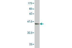 Western Blot detection against Immunogen (37. (TPT1 antibody  (AA 35-138))