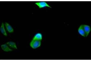 Immunofluorescence staining of Hela Cells with ABIN7127762 at 1:50, counter-stained with DAPI. (Recombinant PIK3CA antibody  (Catalytic Subunit alpha))