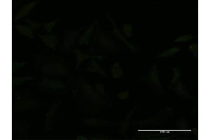Immunofluorescence of monoclonal antibody to USP9X on HeLa cell. (USP9X antibody  (AA 1-90))