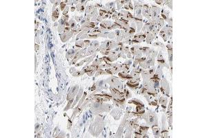 Immunohistochemical staining (Formalin-fixed paraffin-embedded sections) of human heart muscle with PKP2 polyclonal antibody  shows strong cytoplasmic positivity in myocytes. (Plakophilin 2 antibody  (AA 72-194))