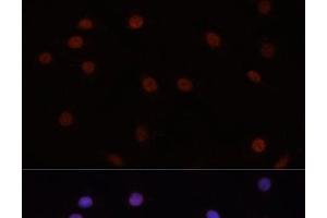 Immunofluorescence analysis of C6 cells using DNMT3B Polyclonal Antibody at dilution of 1:100. (DNMT3B antibody)