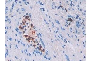 Immunohistochemistry (IHC) image for anti-Interleukin 6 (IL6) (AA 27-212) antibody (ABIN7426637)