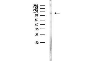 Western blot analysis of lysates from Rat brain, using C Antibody at 1/1000 dilution.