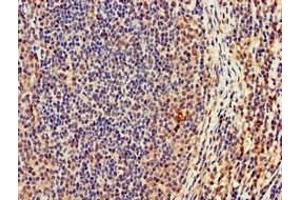 Immunohistochemistry of paraffin-embedded human lymph node tissue using ABIN7165180 at dilution of 1:100 (CASC1 antibody  (AA 1-300))