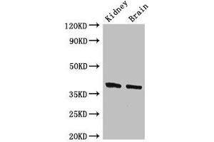 Western Blot Positive WB detected in: Mouse kidney tissue, Mouse brain tissue All lanes: FOXE1 antibody at 2. (FOXE1 antibody  (AA 184-365))
