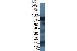 Western blot analysis of Pig Pancreas lysate, using Human SPTbN4 Antibody (1 µg/ml) and HRP-conjugated Goat Anti-Rabbit antibody ( (SPTBN4 antibody  (AA 64-285))