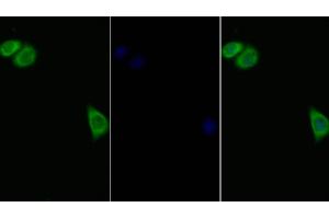 Detection of IL11Ra in Human Hela cell using Polyclonal Antibody to Interleukin 11 Receptor Alpha (IL11Ra)