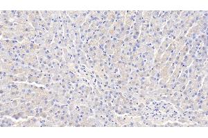 Detection of ADPN in Canine Liver Tissue using Polyclonal Antibody to Adiponectin (ADPN) (ADIPOQ antibody  (AA 18-244))