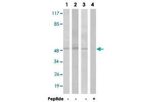 Western blot analysis of extracts from HT-29 cells (Lane 1 and 4), LoVo cells (Lane 2) and A-549 cells (Lane 3), using S1PR1 polyclonal antibody .