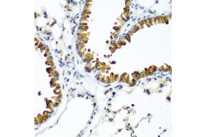 Immunohistochemistry of paraffin-embedded mouse lung using WWTR1 antibody.