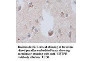 Image no. 1 for anti-Ciliary Neurotrophic Factor Receptor (CNTFR) antibody (ABIN791093)