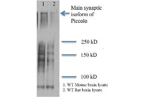 Western Blot analysis of Rat and mouse brain lysates showing detection of Piccolo protein using Mouse Anti-Piccolo Monoclonal Antibody, Clone 6H9-B6 (ABIN863104 and ABIN863105). (Piccolo antibody)