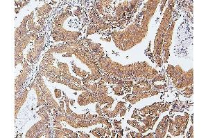 IHC analysis of CDK5 using anti-CDK5 antibody (ABIN6719393).