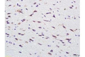 Paraformaldehyde-fixed, paraffin embedded EGFR5 Polyclonal Antibody, Antigen retrieval by boiling in sodium citrate buffer (pH6) for 15min, Block endogenous peroxidase by 3% hydrogen peroxide for 30 minutes, Blocking buffer (normal goat serum) at 37°C for 20min, Antibody incubation with 	EGFR5 Polyclonal Antibody, Unconjugated  at 1:500 overnight at 4°C, followed by a conjugated secondary and DAB staining. (CLEC14A antibody  (AA 260-310))