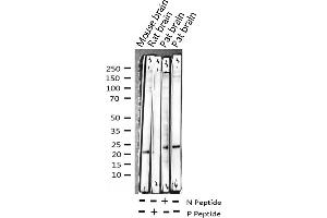 CPI-17 antibody  (pThr38)