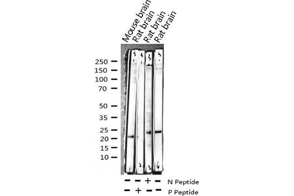 CPI-17 antibody  (pThr38)