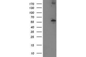 Western Blotting (WB) image for anti-Protein Phosphatase, Mg2+/Mn2+ Dependent, 1B (PPM1B) antibody (ABIN1500375) (PPM1B antibody)