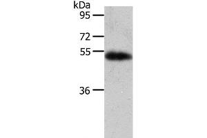 Western Blot analysis of Human liver cancer tissue using AGT Polyclonal Antibody at dilution of 1:700 (AGT antibody)