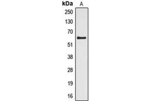 Western blot analysis of Cytochrome P450 4Z1/2 expression in HL60 (A) whole cell lysates. (Cytochrome P450 4Z1/2 (Center) antibody)