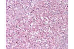 Anti-TERF2 antibody IHC of human tonsil. (TRF2 antibody)