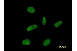 Immunofluorescence of purified MaxPab antibody to ORC6L on HeLa cell. (ORC6 antibody  (AA 1-252))