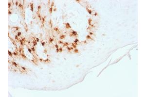 Formalin-fixed, paraffin-embedded human Skin stained with MART-1 Rabbit Recombinant Monoclonal Antibody (MLANA/1761R) (HRP-DAB). (Recombinant MLANA antibody)