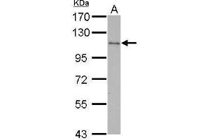 WB Image CBL antibody [C2C3], C-term detects CBL protein by Western blot analysis. (CBL antibody  (C-Term))