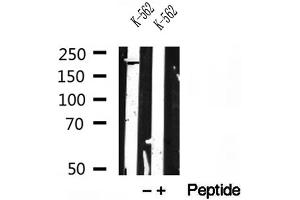 Western blot analysis of extracts of K-562 cells, using RB1CC1 antibody.