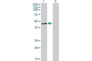 Western Blotting (WB) image for anti-Zinc Finger Protein 24 (ZNF24) (AA 1-369) antibody (ABIN599467) (ZNF24 antibody  (AA 1-369))
