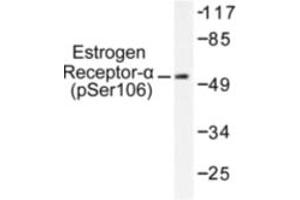 Image no. 1 for anti-Estrogen Receptor 1 (ESR1) (pSer106) antibody (ABIN318017)
