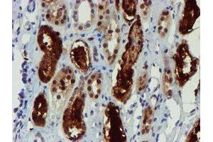Immunohistochemistry (IHC) image for anti-NQO2 (NQO2) antibody (ABIN1499816)
