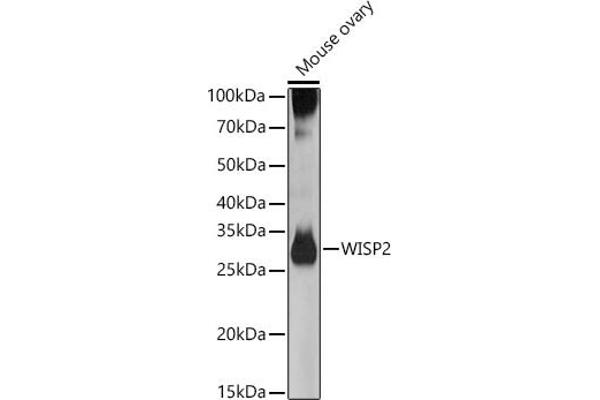 WISP2 anticorps  (AA 1-250)