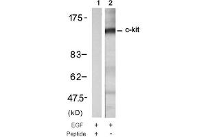Image no. 1 for anti-Mast/stem Cell Growth Factor Receptor (KIT) (Tyr721) antibody (ABIN319334) (KIT antibody  (Tyr721))