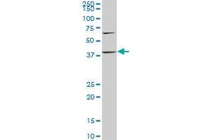 PTX3 monoclonal antibody (M02), clone 2B10. (PTX3 antibody  (AA 282-380))