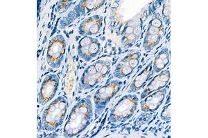 Immunohistochemistry analysis of paraffin embedded rat colon using CYPIW1 (ABIN7073674) at dilution of 1: 500 (CYP2W1 antibody)