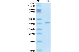 Mouse CCL5 on Tris-Bis PAGE under reduced condition. (CCL5 Protein (AA 24-91) (Fc Tag))
