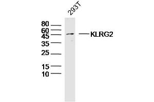 293T lysates probed with KLRG2 Polyclonal Antibody, Unconjugated  at 1:300 dilution and 4˚C overnight incubation. (KLRG2 antibody  (AA 101-200))